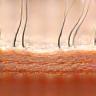 Close view of hair roots and scalp